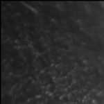 Improved MetCombi Plasma ELISA