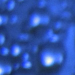 T2Bacteria® Panel