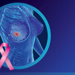 Biocartis – Breast Cancer Portfolio