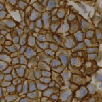 Discover the HER2 Analyte Control – DR