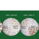 HistoCyte analytes MMR & NTRK
