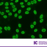 Immuno Concepts: PSITS Program 2025