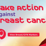 Abacus dx Cancer Diagnostics – Breast Cancer