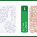 Histocyte BRAF Analyte Control IHC