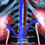 Automated solution for measurement of TRAcP 5b in renal patients