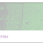 Immuno Concepts – ANCA-L Newsletter