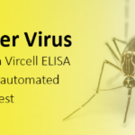 Vircell Ross River Virus (RRV) IgG and IgM testing solution