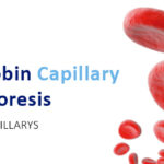 Capillary Electrophoresis – Comprehensive haemoglobin testing for all variants