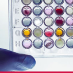 Theradiag UEG Week Abstract