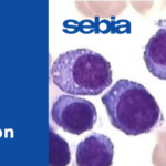 New Publication:  A Novel Approach to Estimating M-Protein Concentration: Capillary Electrophoresis Quantitative Immunosubtraction