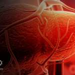 Hepatitis E VirClia – fully automated solution for Hepatitis E serology