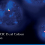 ZytoVision FISH detection of CIC gene