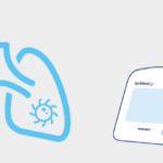 CRP and pulmonary findings correlate in COVID-19