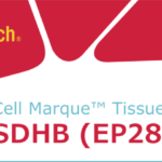 Cell Marque SDHB antibody for GIST now available