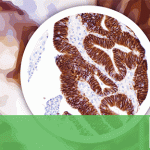 Novel Gastrointestinal (GI) Markers from Cell Marque
