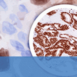 Novel Genitourinary (GU) Markers from Cell Marque