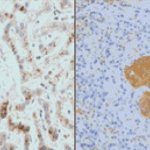 Importance of LC3 in Autophagy