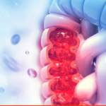 Blood soluble OX40 (CD134) levels in advanced colorectal cancer