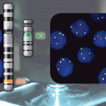 Detection of BCR/ABL1 Fusion